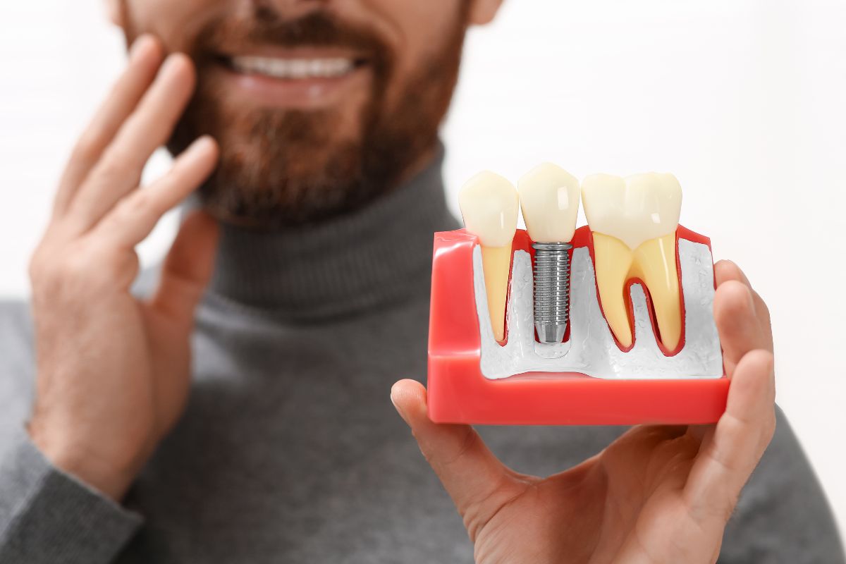 Dental Implants: The Permanent Solution for Missing Teeth That Looks & Feels Natural