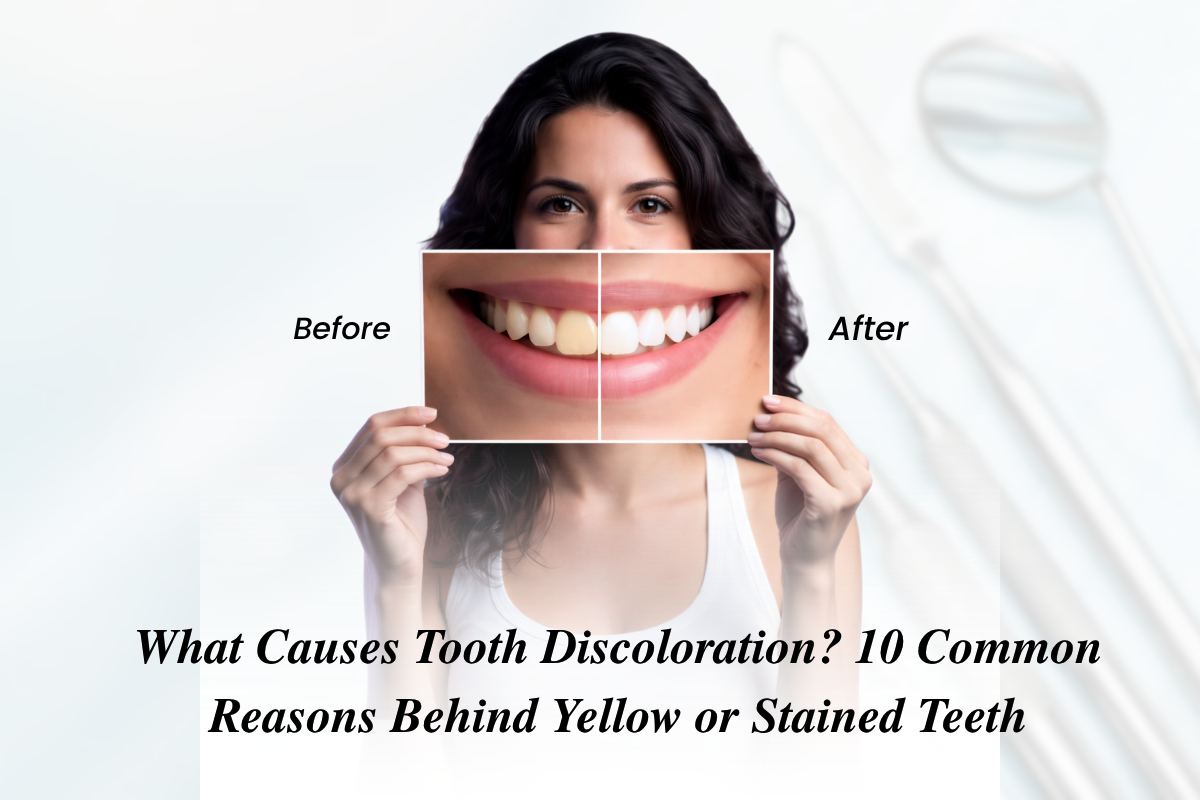 What Causes Tooth Discoloration 10 Common Reasons Behind Yellow or Stained Teeth