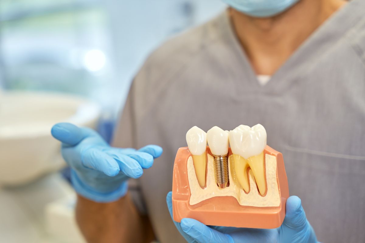 how long do dental implants last